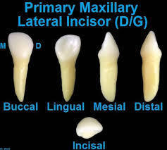 Deciduous Maxillary lateral incisor