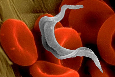 DOENÇA DE CHAGAS: qual o agente etiológico?