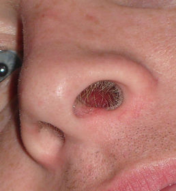 What are vibrissae?