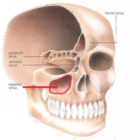 Describe the position of the maxillary sinuses.