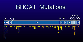 ¿Cuál es el gen más frecuentemente implicado en el síndrome de cáncer de mama hereditario?: