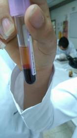 Sangre del sapo en tres capas (plasma, glóbulos blancos y eritrocitos)
