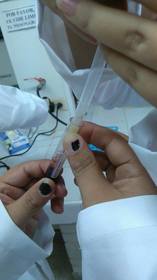 Se retira el plasma ambas muestras