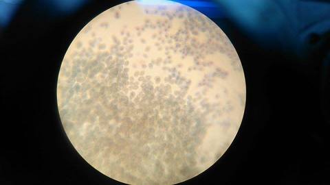 •Se colocó una pequeña gota de la muestra de la capa dos (glóbulos blancos),en uno de los extremos de una lámina portaobjetos y se cubrió...
