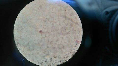 Membranas presentes en la sangre