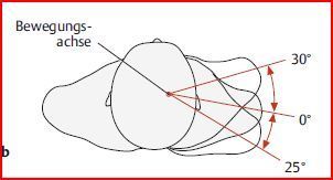 Anteversion &amp; Retroversion