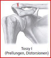 Tossy I