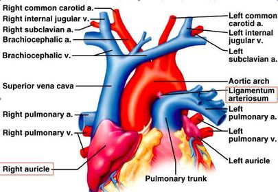 What is the ligamentum arteriosum?