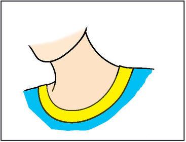 Neck