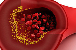 Brand name: Coumadin Generic name: Warfarin