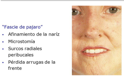 Fascie de Pajaro