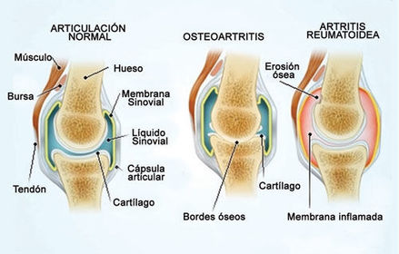 Dx Diferencial