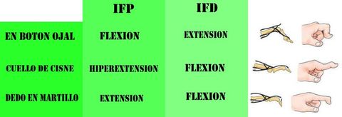 DX Diferencial de las Deformidades de las Falanges