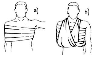 TPI
