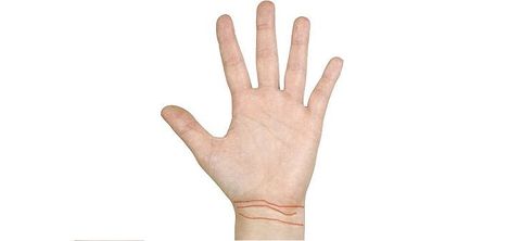 mano