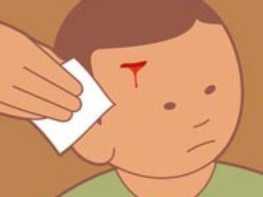 Presente: Bleed Pasado: Bled Participio: Bled