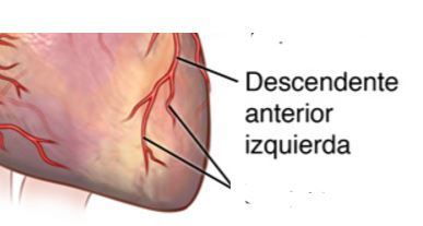 Cual es la arteria coronaria que irriga la porcion lateral del ventriculo izquierdo: