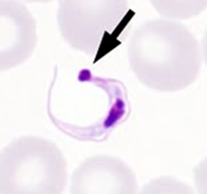 Trypanosoma cruzi