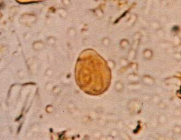 Chilomastix mesnili (cyst)