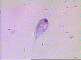 Chilomastix mesnili (trophozoite)