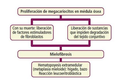 SÍNDROMES MIELOPROLIFERATIVOS CRÓNICOS MIELOFIBROSIS IDIOPÁTICA Etiopatogenia