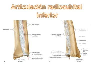 Radio-cubital Inferior Es del tipo trocoide. Movimientos: Pronación y supinación del antebrazo (Ulna y radio se cruzan formando una X) Es...