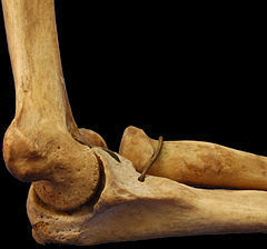 Humero-Cubital Es una diartrosis del tipo condilea. Movimientos: Flexión-extensión, pronación y supinación. Superficies articulares: Húme...