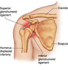 Glenohumeral La articulación del hombro o glenohumeral es una articulación perteneciente al grupo de las enartrosis, variedad de diartros...