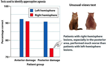 The unusual-views test: Used to identify apperceptive agnosia