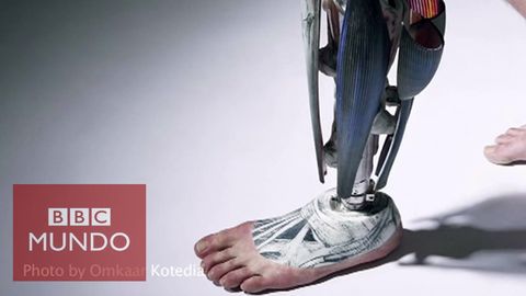 QUE TIPO DE PROTESIS EXISTEN: *La prótesis dental *protesis de mano *protesis de pie
