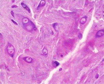 White - Fibro Cartilage
