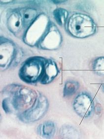 Hyaline Cartilage