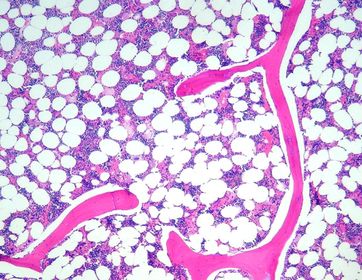 Bone Marrow