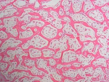 Spongy Bone