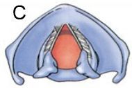 Complete separation/abduction of the vocal cords and arytenoid catilages, shown above, happens when you 1) Speak 2) Cough 3) Breathe 4) W...