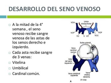 El crecimiento diferencial del seno venoso derecho también empuja al vestigio del asta sinusoidal izquierda ( el futuro seno coronario) h...