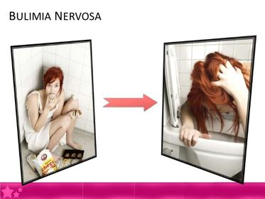 Bulimia Nervosa