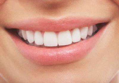 LA SONRISA
