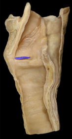 Vestibular Fold