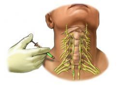 Name the structure being anesthetized: Location: