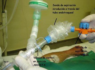 INTUBACION ENDOTRAQUEAL,TUBO TOTAXICO, ENDOTRAQUEALES