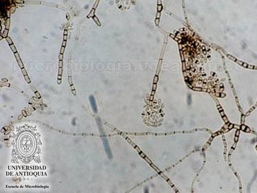 MICOLOGIA
