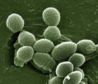 Enterococcus faecalis