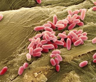 Pseudomonas aeruginosa