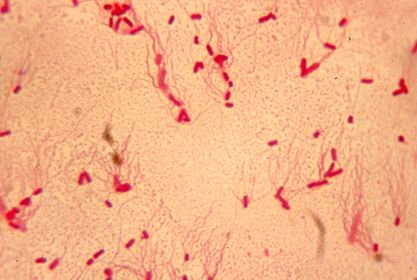 Salmonella thyphi