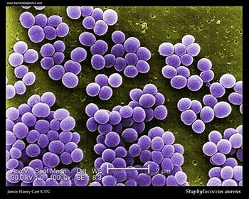 Staphylococcus aureus resistente a oxacilina proveniente de la comunidad.