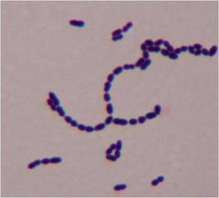 Streptococcus pyogenes