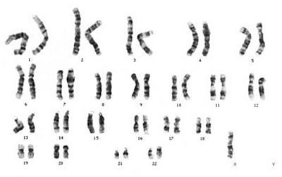 alterações cromossmicas