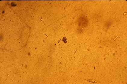 Ancylostoma Strongyle