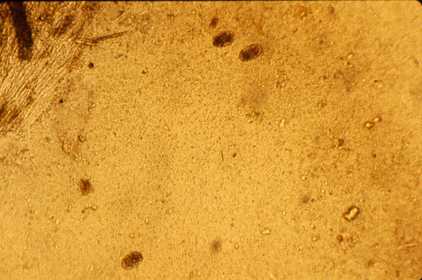 Ancylostoma Strongyle